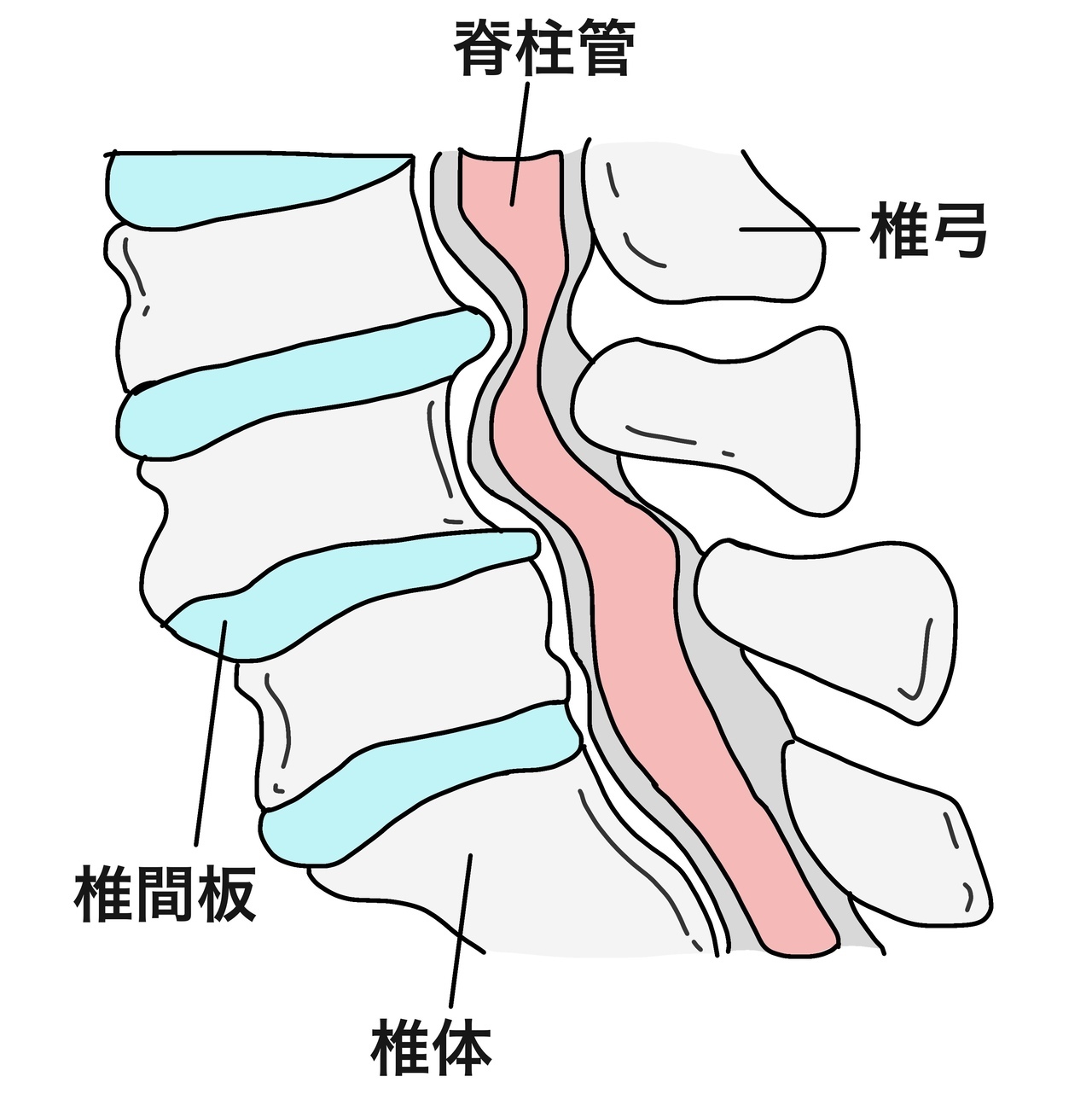 西宮市の鍼灸院松本はりきゅう施術院の脊柱管狭窄症のイメージ