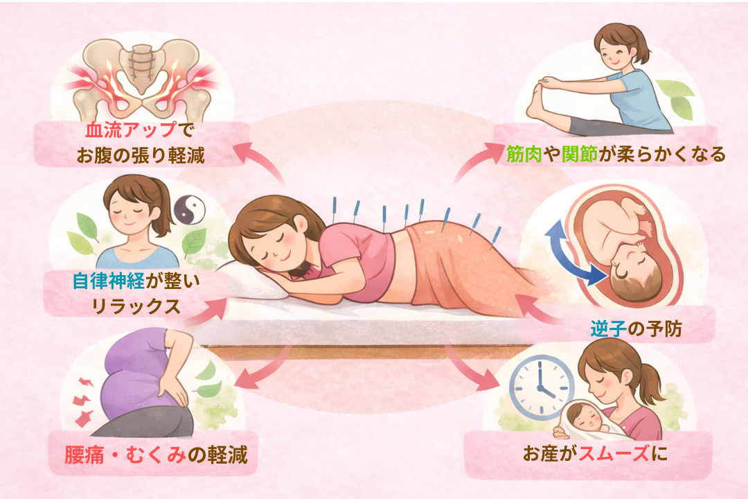 西宮市の鍼灸院松本はりきゅう施術院、安産鍼灸で期待できる効果の図解